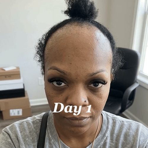 Zorevia™ Batana Natural Hair Growth Oil