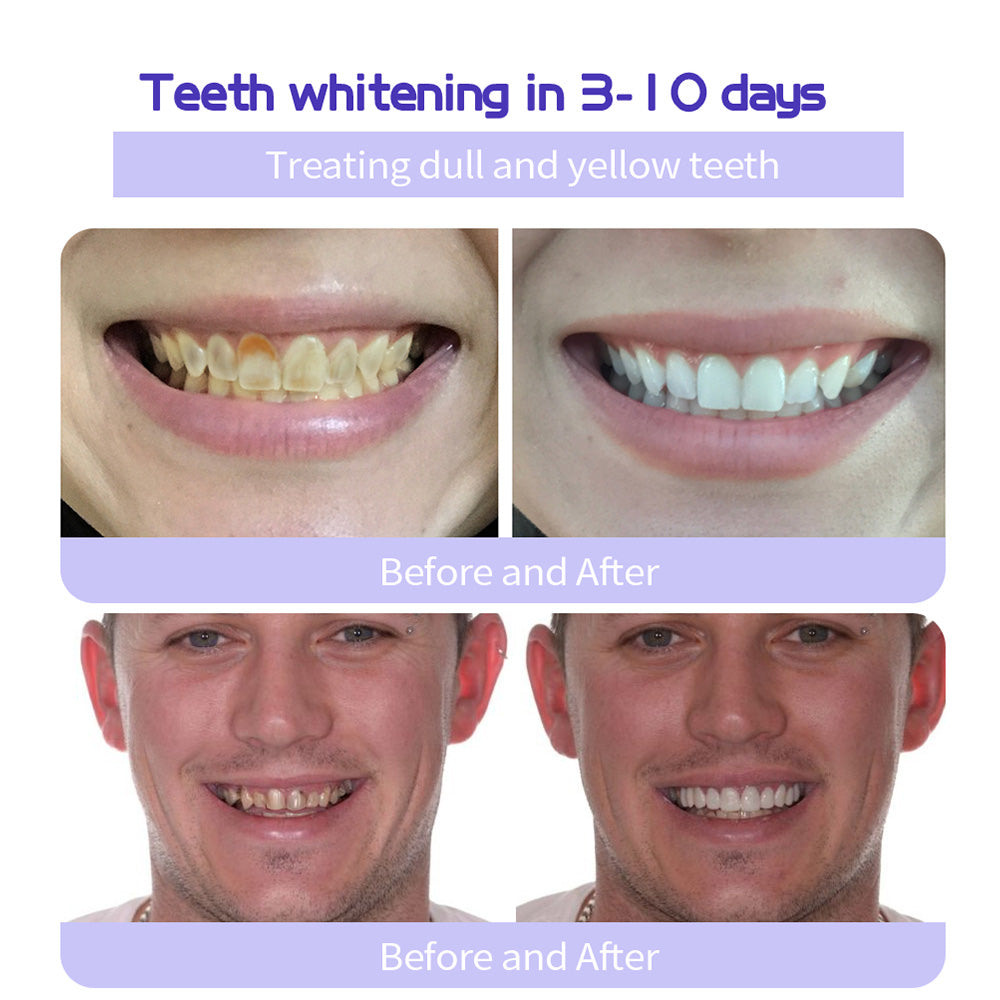 Last Day Promotion 60% OFF⏰ Teeth Whitening Mineral Powder  – Yellow Stains Gone in 3 Days