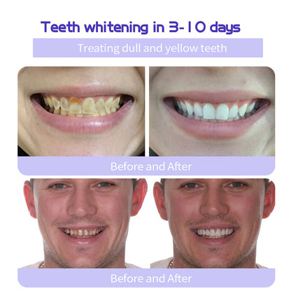 Last Day Promotion 60% OFF⏰ Teeth Whitening Mineral Powder  – Yellow Stains Gone in 3 Days