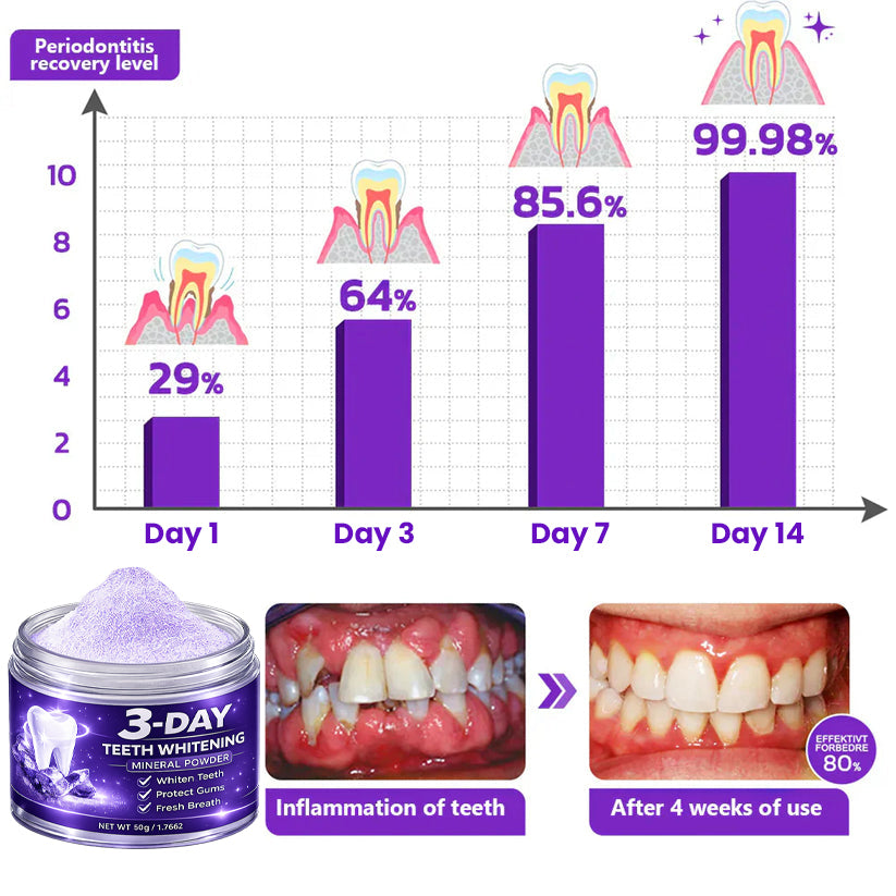 Last Day Promotion 60% OFF⏰ Teeth Whitening Mineral Powder  – Yellow Stains Gone in 3 Days