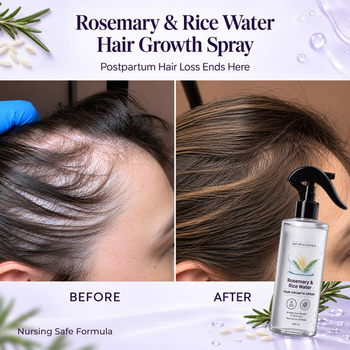 Rosemary & Rice Water Hair Growth Spray - Postpartum Hair Recovery