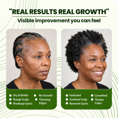 Zorevia™ Batana Natural Hair Growth Oil