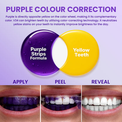 V34 Whitening Strips – Professional Teeth Whitening at Home