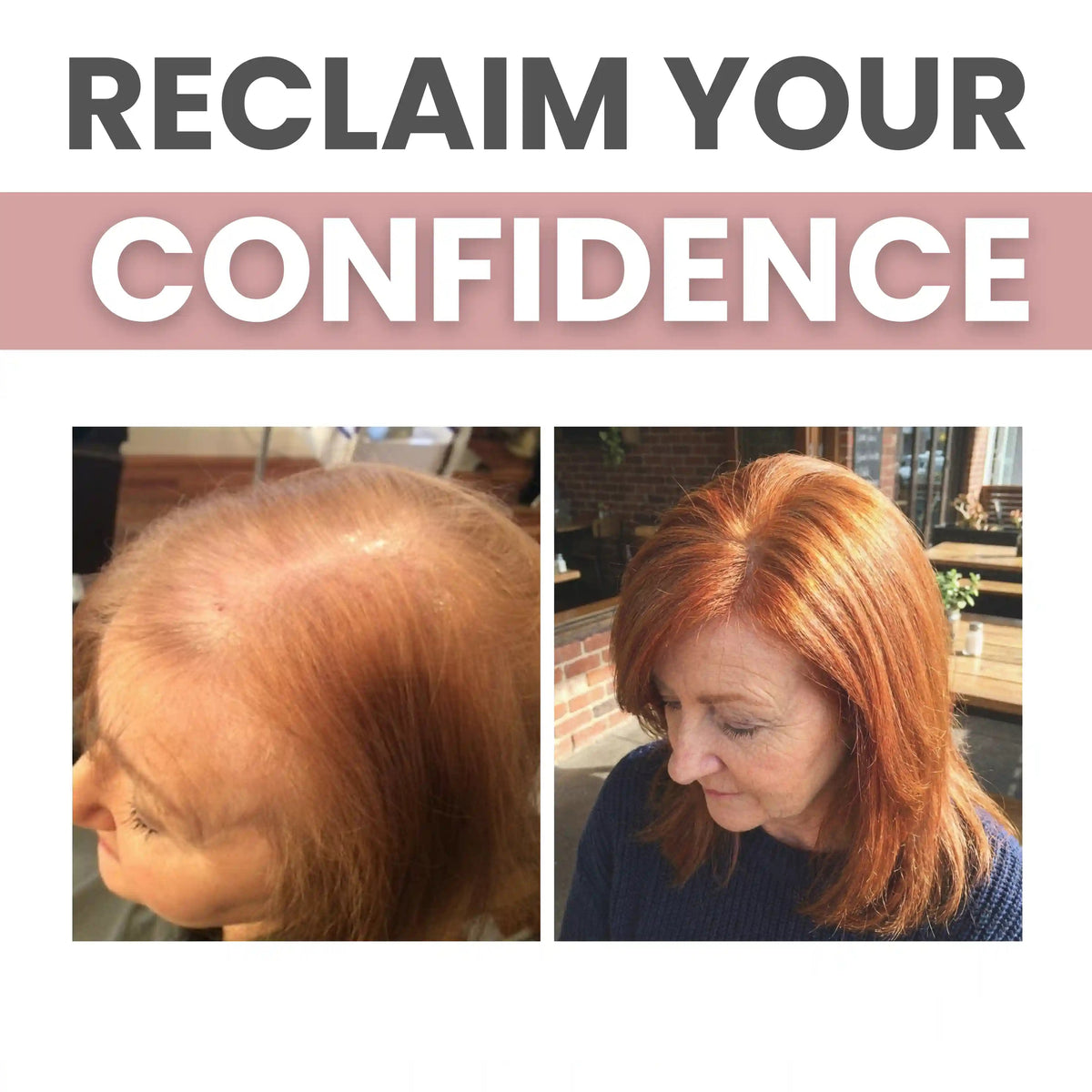 FoliGrow™ Advanced Dual-Peptide Hair Booster 🏆 Highest-Rated Hair Growth Solution of 2026