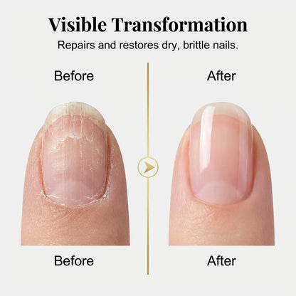 Save 60% Today Only 🔥3-Day Bare Nail Renewal Serum for Dry, Weak-Looking Nails