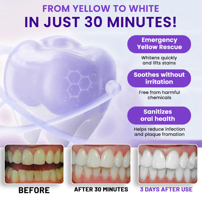 V34 Whitening Strips – Professional Teeth Whitening at Home