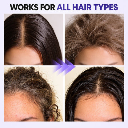 Rosemary & Rice Water Hair Growth Spray - Postpartum Hair Recovery
