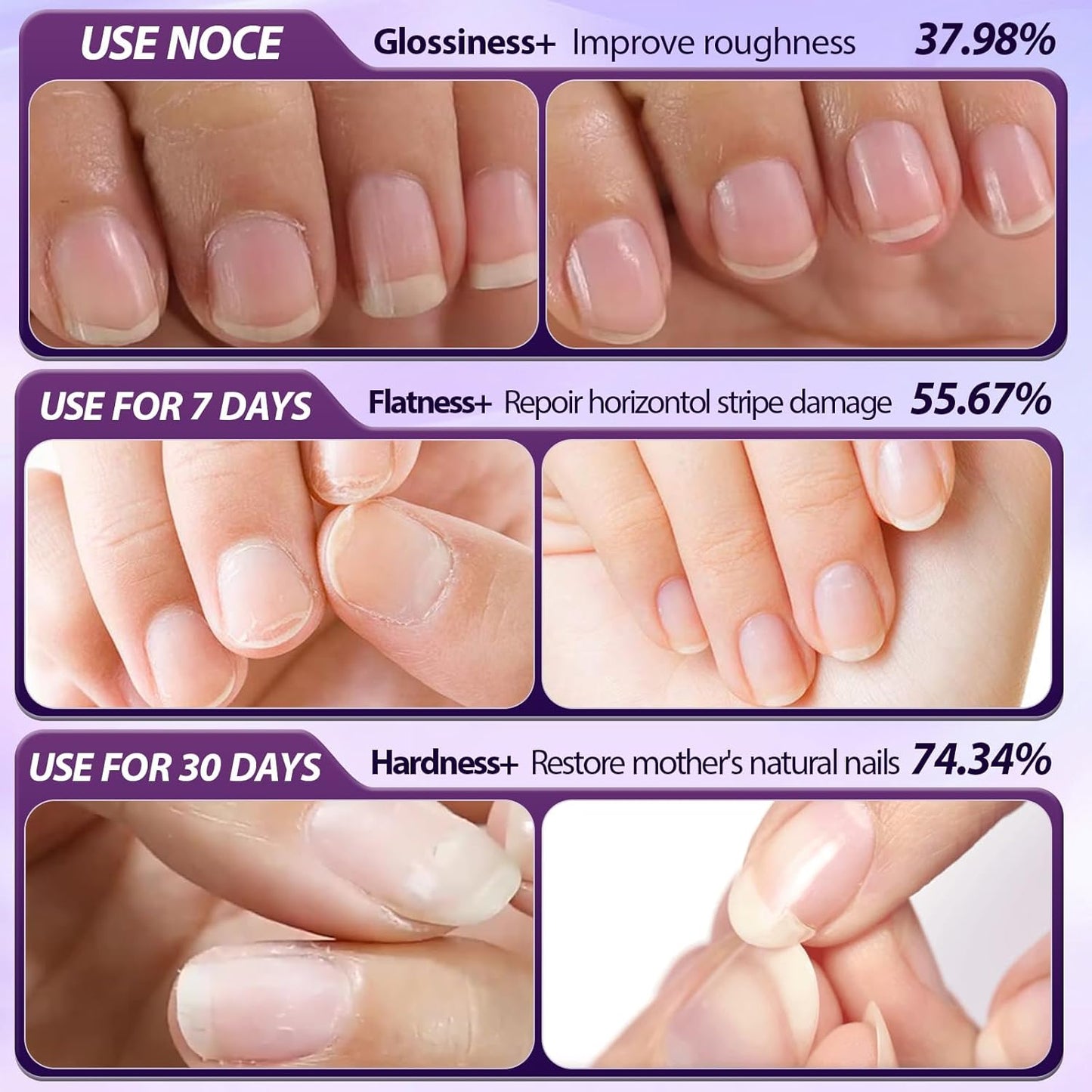 2026 New Upgraded 3-in-1 Cuticle Pusher & Oil Pen💅