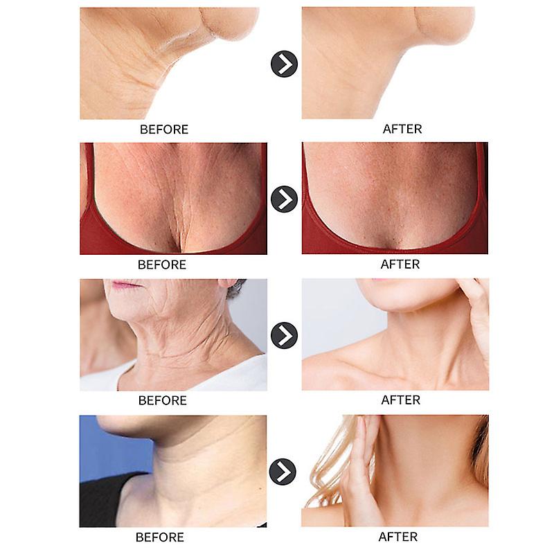 ✨Last Day Promotion 60% OFF ⏰ Collagen Firming & Wrinkle Cream with Five Rollers for All Around Massage