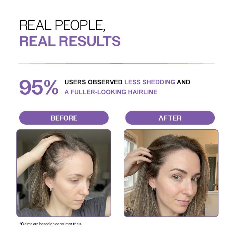 Rosemary & Rice Water Hair Growth Spray - Postpartum Hair Recovery
