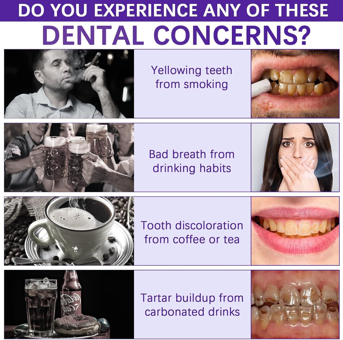✨Last Day Promotion 60% OFF ⏰ Purple Brightening Teeth Powder – Removes Stains, Enamel Safe & Sensitivity