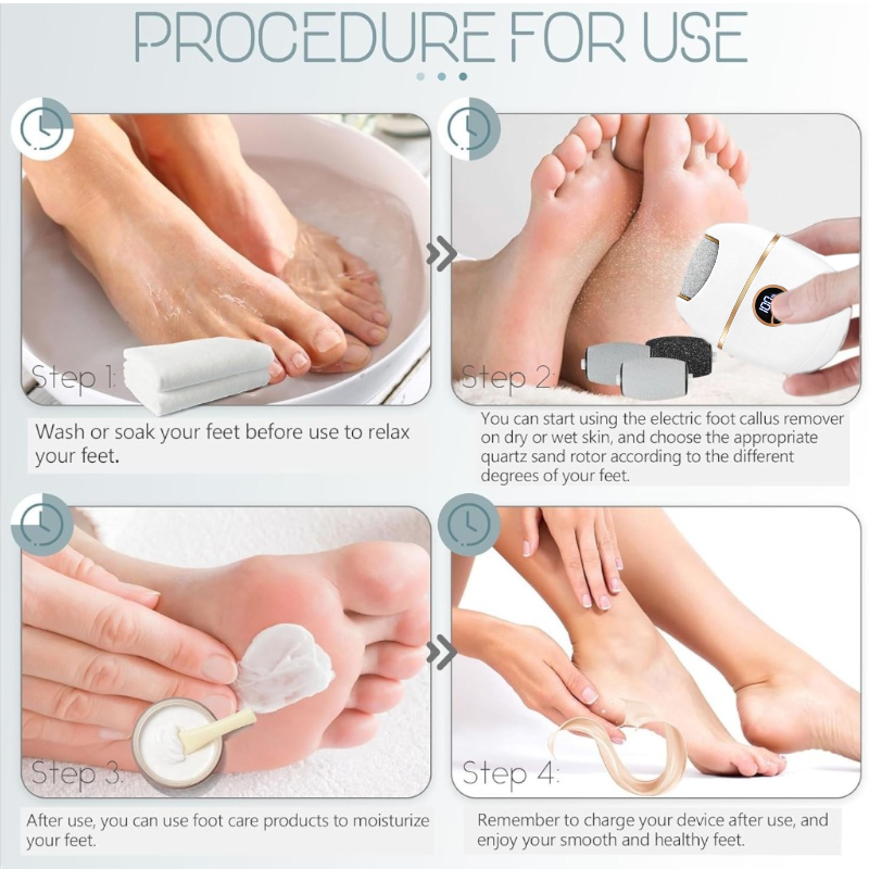 FLASH SALE 60% OFF + FREE SHIPPING⏰Electric Foot Callus Remover - 2026 Upgrade Version