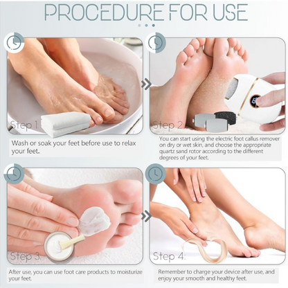 FLASH SALE 60% OFF + FREE SHIPPING⏰Electric Foot Callus Remover - 2026 Upgrade Version