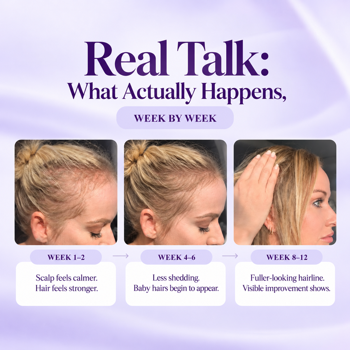 Rosemary & Rice Water Hair Growth Spray - Postpartum Hair Recovery