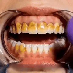 Last Day Promotion 60% OFF⏰ Teeth Whitening Mineral Powder  – Yellow Stains Gone in 3 Days
