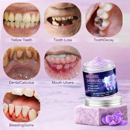 Advanced Teeth Whitening Powder – 2026 Expert-Formulated Whitening  Fomula 🔥 SUMMER SALE 60%
