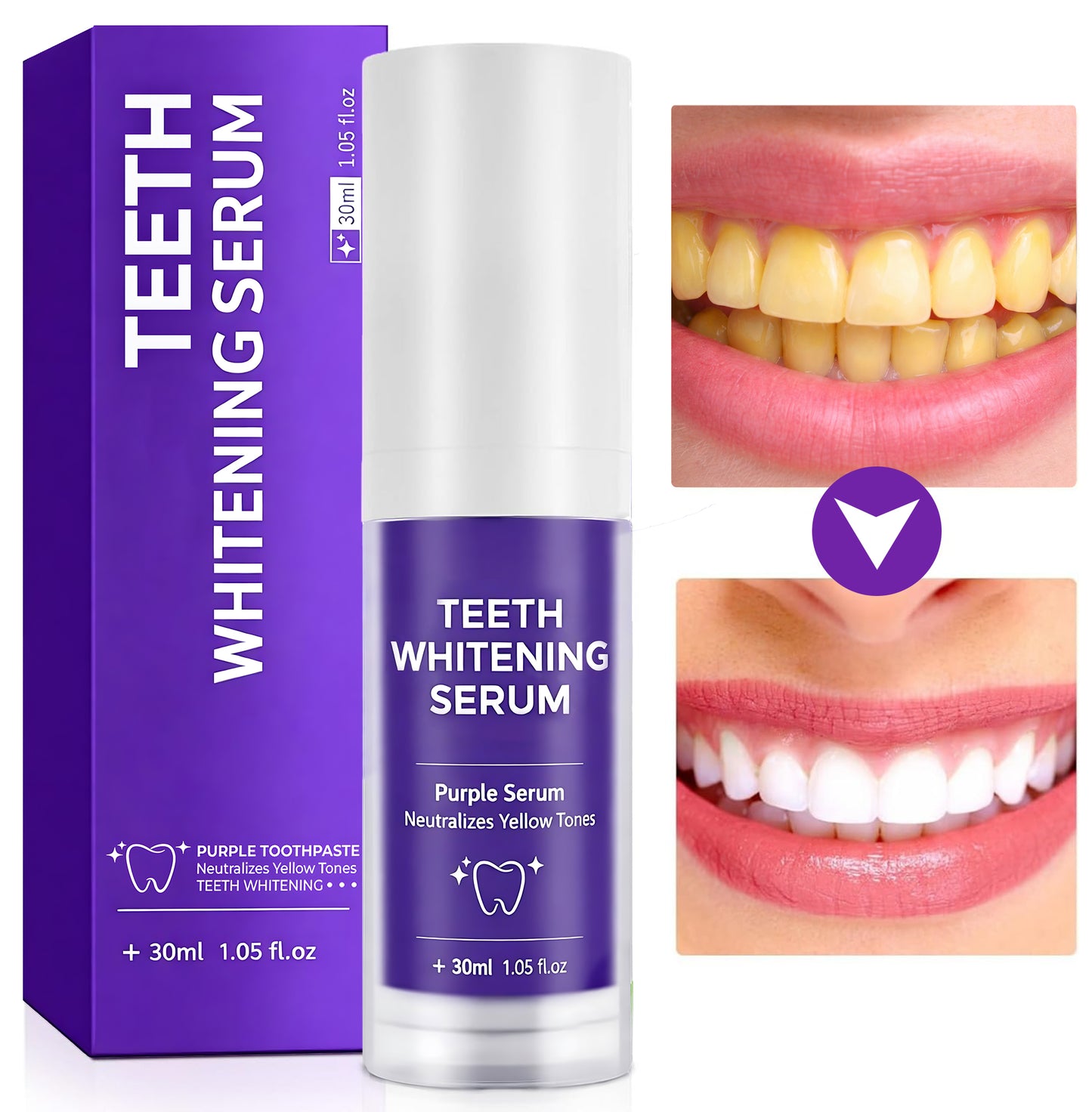 FALSH SALE 60% OFF + FREESHIP🔥V34 Teeth Whitening Serum ✨Dentist‑Developed Whitening Formula
