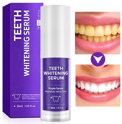 FALSH SALE 60% OFF + FREESHIP🔥V34 Teeth Whitening Serum ✨Dentist‑Developed Whitening Formula