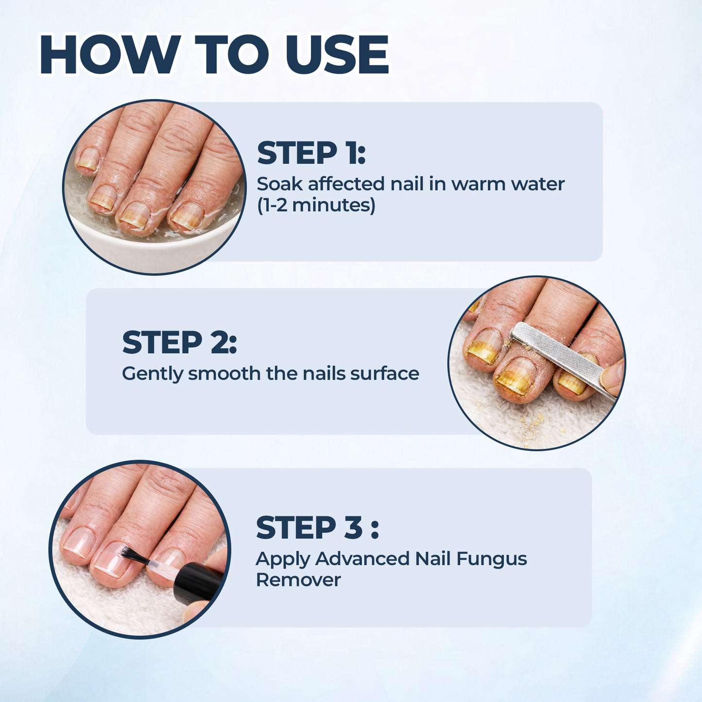 Last Day Promotion 60% OFF + FREE SHIPPING⏰ Advanced Nail Fungus Remover ✨ Visible Renewal in Week