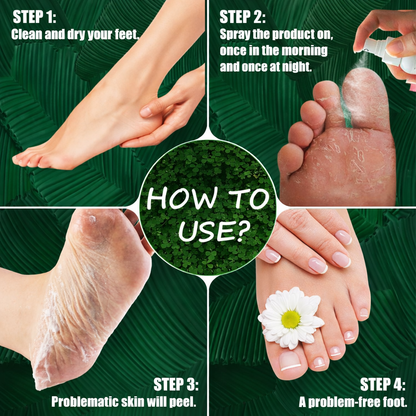 🔥HOT DEAL 60% OFF 🔥 Foot Ginger Callus Remove Spray - Smooth Feet in Just 7 Days