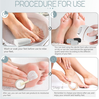 Electric Foot Callus Remover US