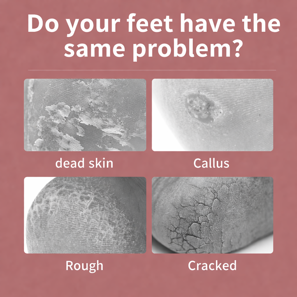 2026 New Upgraded Electric Foot File US