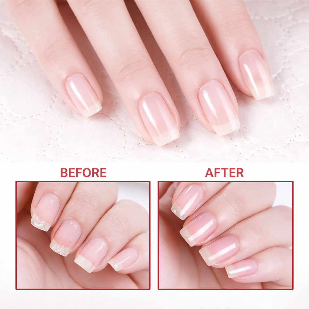 🎉Best Seller-60% Off💖 Keratin + Vitamins C Nail & Cuticle Oil, Impove Cracked Nails & Rigid Cuticles, Deep Moisture For Nails And Cuticles For Nail Growth