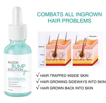 Ingrown Hair Repair Serum