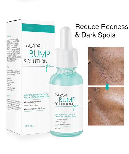 Ingrown Hair Repair Serum