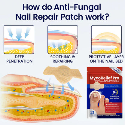 Last Day Promotion 60% OFF⏰ MycoRelief Pro Fungal Nail Patches✨ From Yellow to Healthy Nails in 5 Days