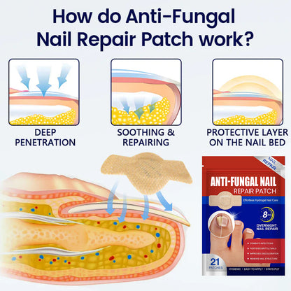 Anti-Fungal Nail Repair Patch