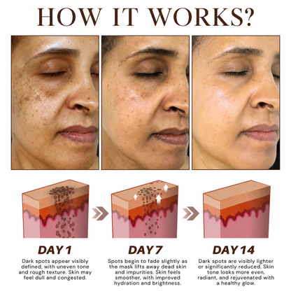 Last Day Promotion 60% OFF🔥 Herbal Spots Peel-Off Facial Mask