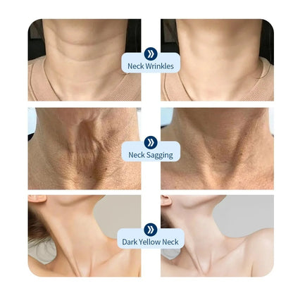 ✨Last Day Promotion 60% OFF ⏰ Collagen Firming & Wrinkle Cream with Five Rollers for All Around Massage