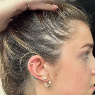 Rosemary & Rice Water Hair Growth Spray - Postpartum Hair Recovery