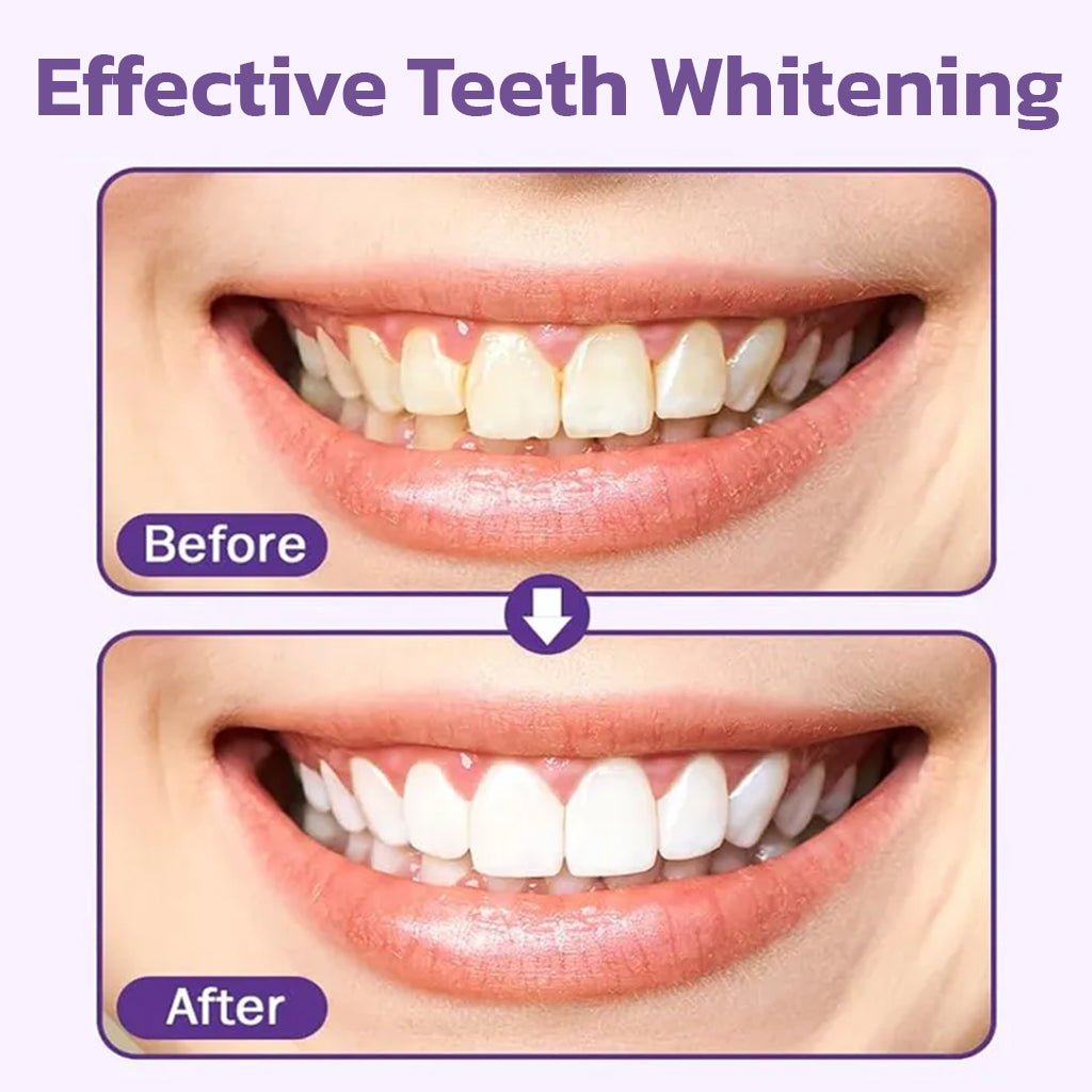 Last Day Promotion 60% OFF🔥 Advanced Mineral Whitening Tooth Powder - Removes Stains, No Sensitivity