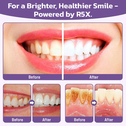 Last Day Promotion 60% OFF🔥 Advanced Mineral Whitening Tooth Powder - Removes Stains, No Sensitivity