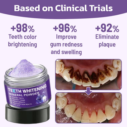 Last Day Promotion 60% OFF🔥 Advanced Mineral Whitening Tooth Powder - Removes Stains, No Sensitivity