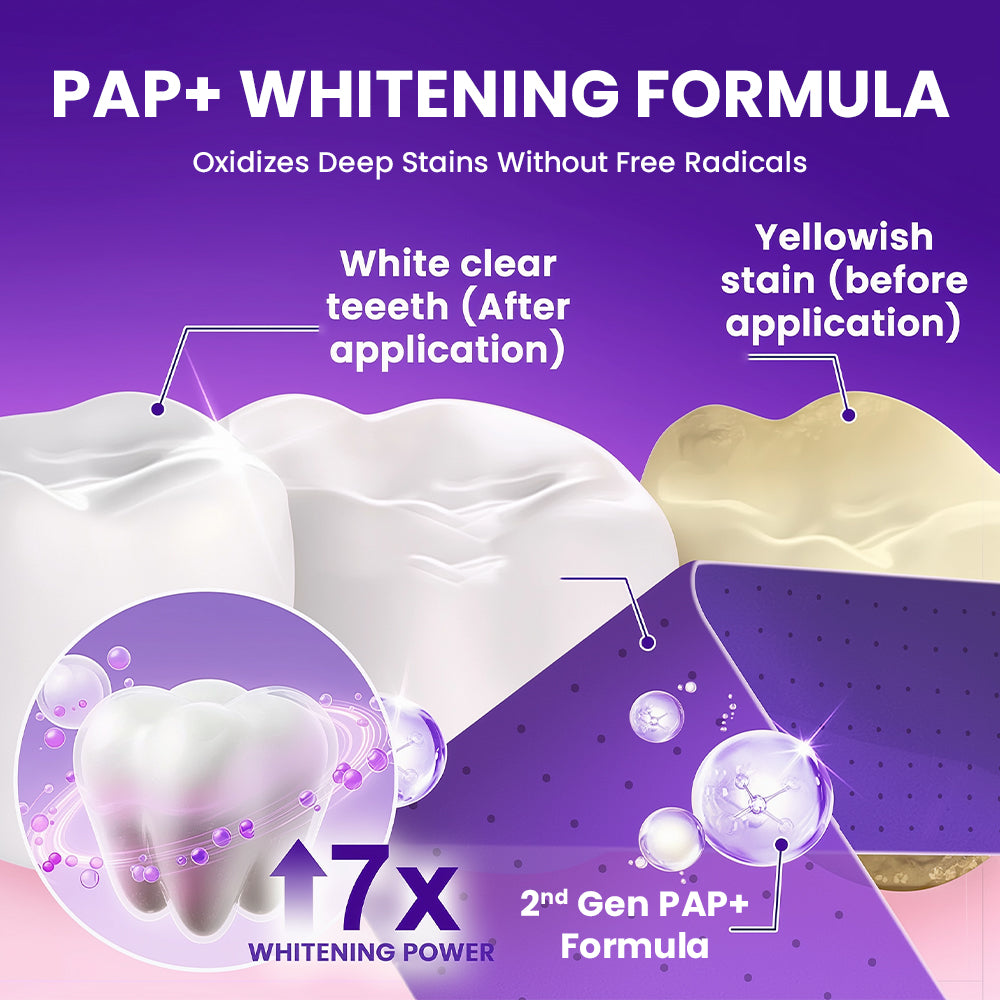 V34 Whitening Strips – Professional Teeth Whitening at Home