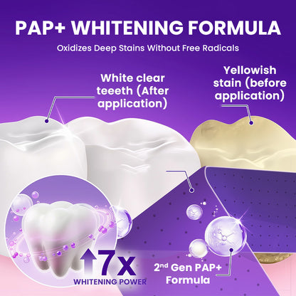 V34 Whitening Strips – Professional Teeth Whitening at Home