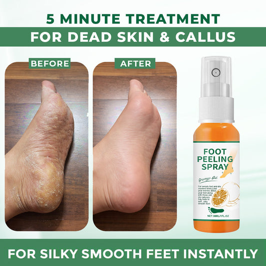 HOT SALE 60% OFF🔥 Orange Oil Foot Callus Removal Spray – Smooth & Callus-Free in 5 Minutes