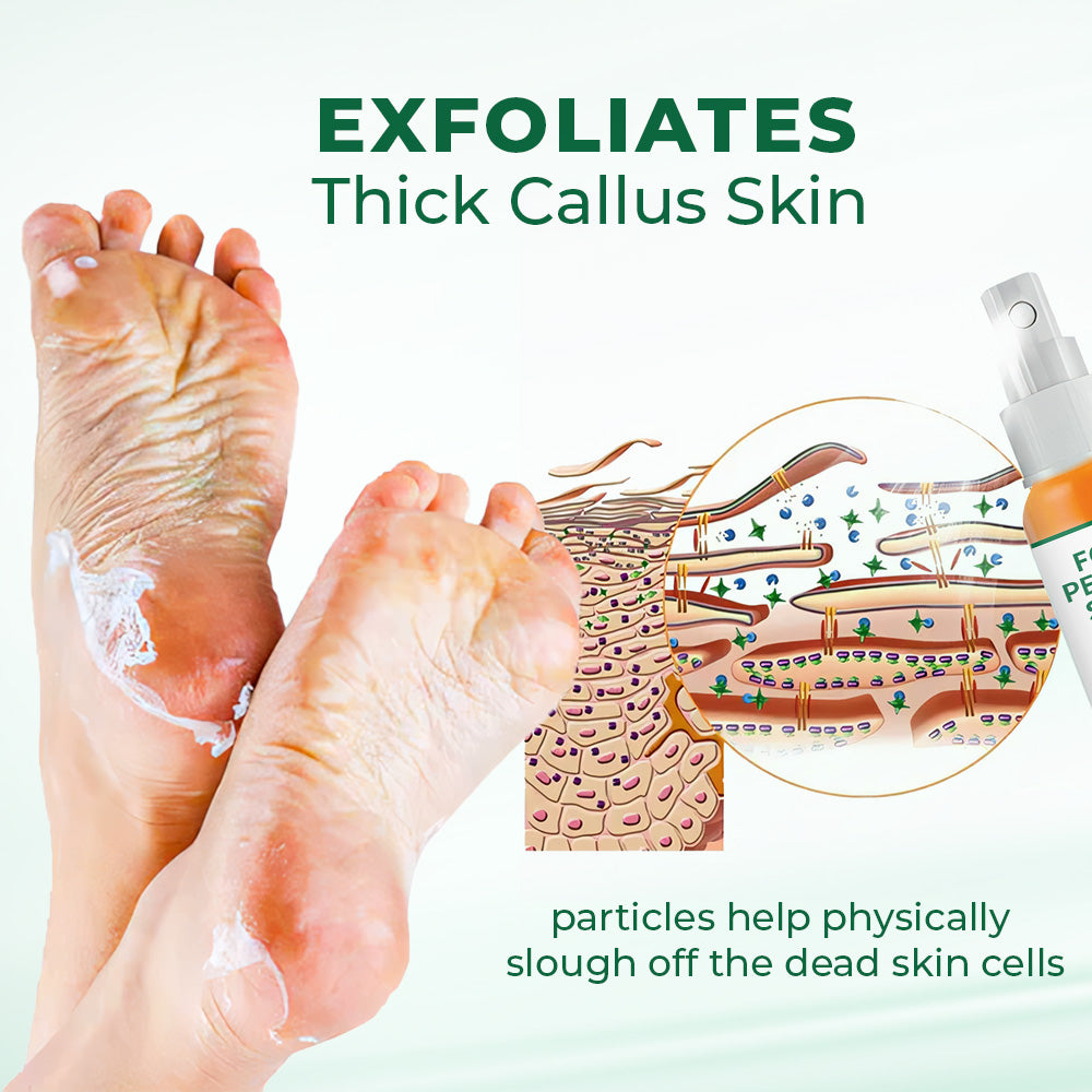 Last Day Promotion 60% OFF🔥 Orange Oil Foot Callus Removal Spray – Smooth & Callus-Free in 5 Minutes