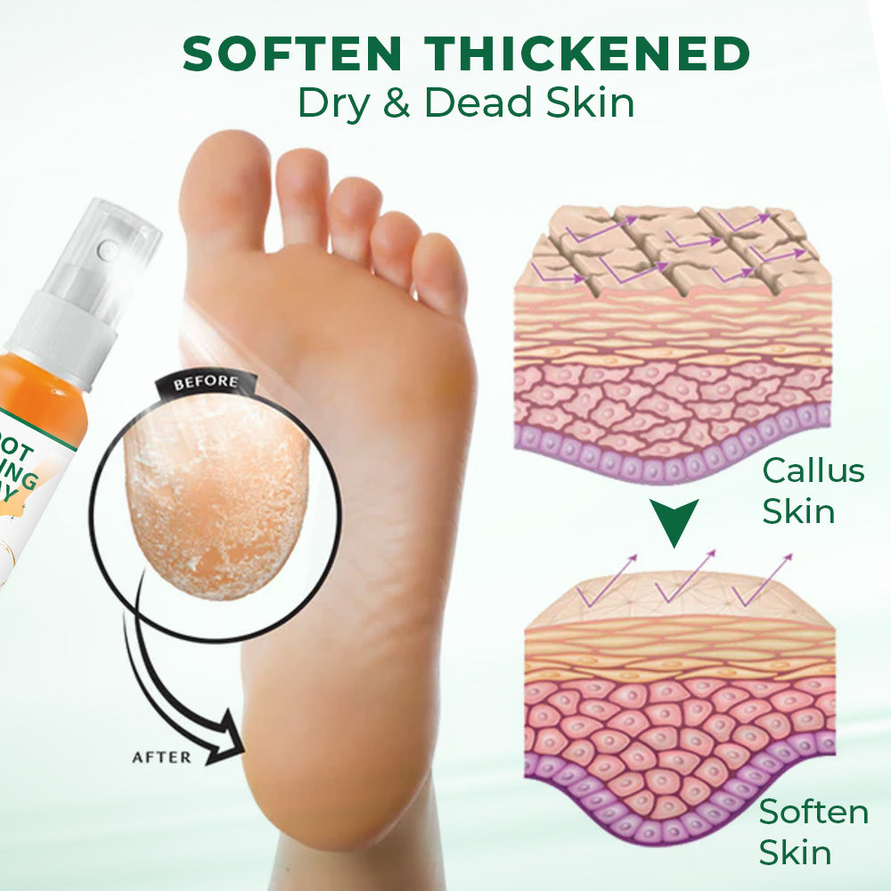 Last Day Promotion 60% OFF🔥 Orange Oil Foot Callus Removal Spray – Smooth & Callus-Free in 5 Minutes