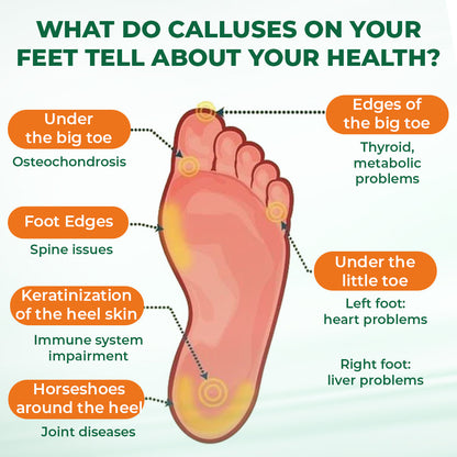 Last Day Promotion 60% OFF🔥 Orange Oil Foot Callus Removal Spray – Smooth & Callus-Free in 5 Minutes
