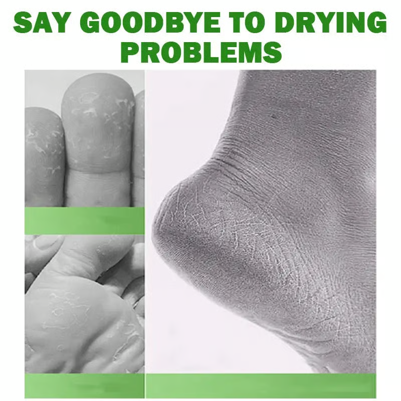 🔥60% OFF + FREESHIP🔥Tea Tree Oil Foot Cream