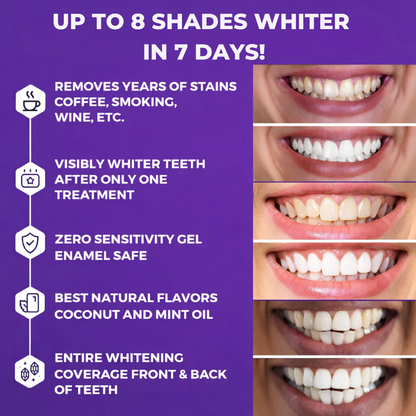 ⏰Last Day Promotion 60% OFF🔥 Purple Teeth Whitening Strips