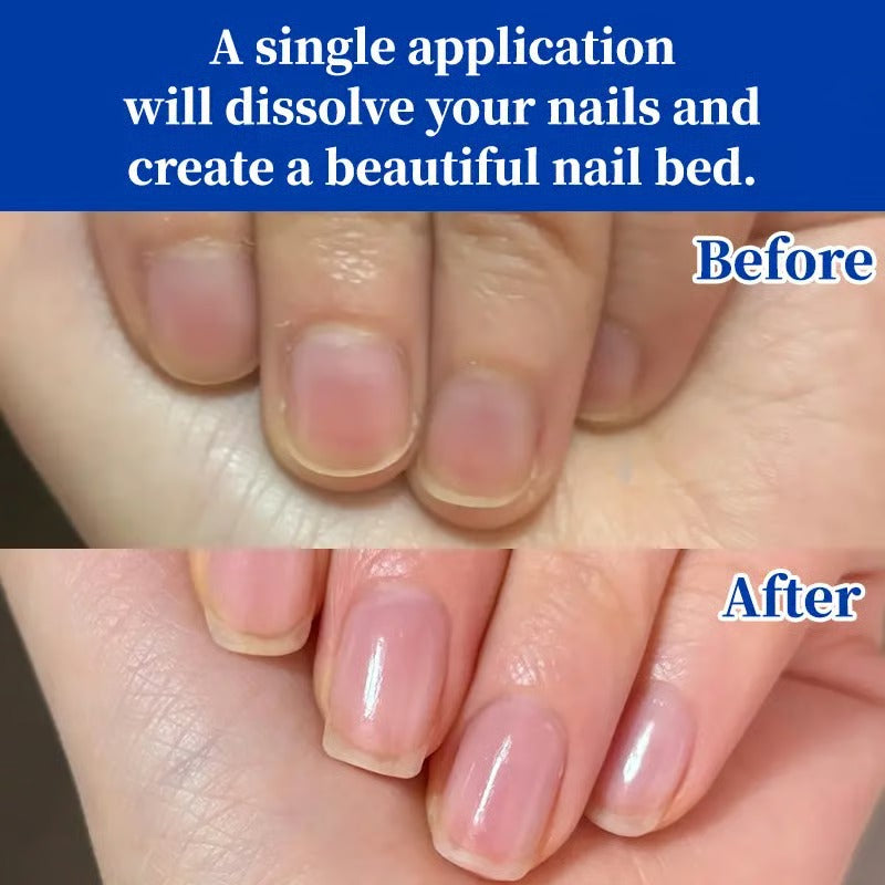 🎉Just Today Offer 60% Off 💖 Antifungal Nail Repair & High-Gloss Shine Solution, Salon-Perfect Results