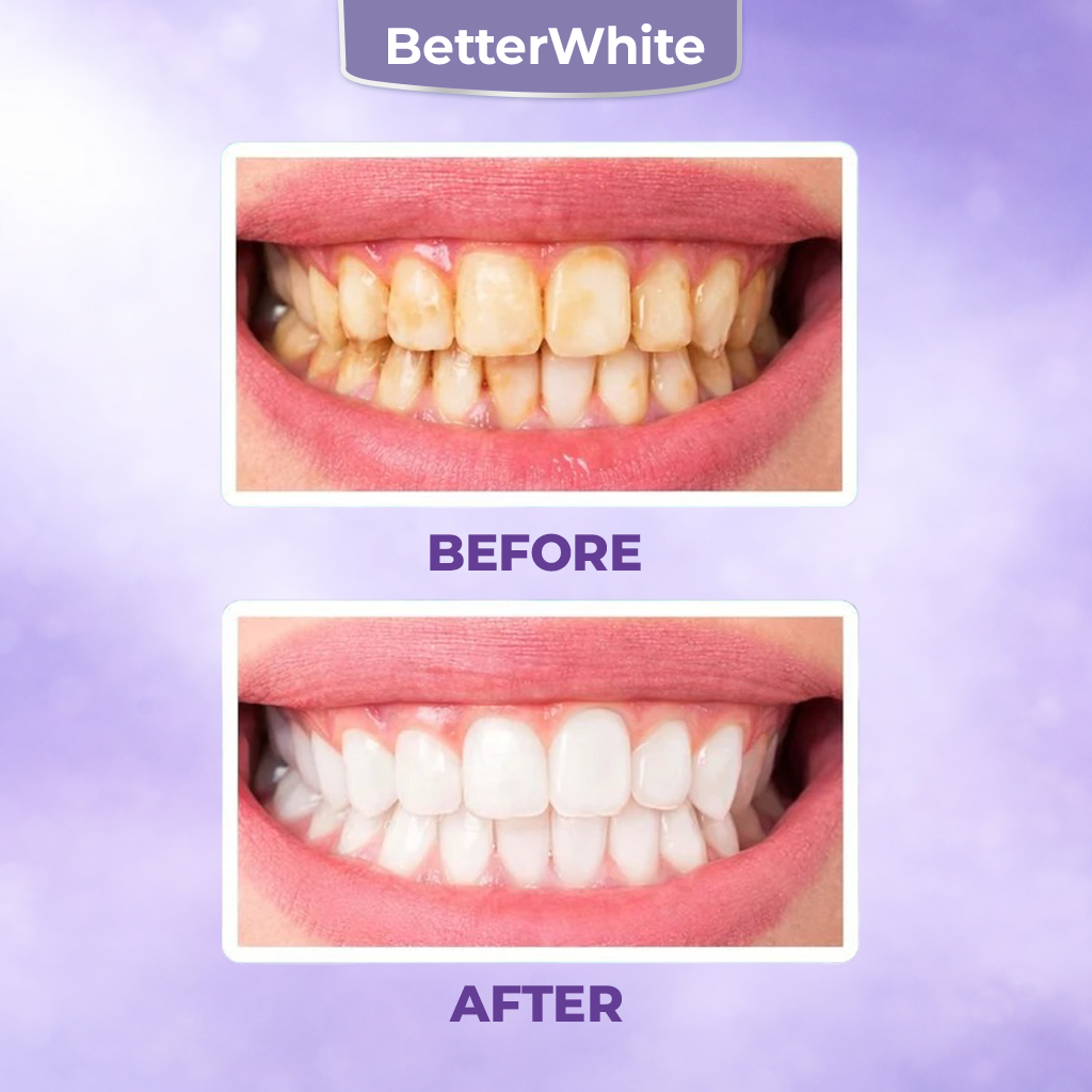 Advanced Teeth Whitening Powder – 2026 Expert-Formulated Whitening  Fomula 🔥 SUMMER SALE 60%