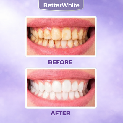 Advanced Teeth Whitening Powder – 2026 Expert-Formulated Whitening  Fomula 🔥 SUMMER SALE 60%