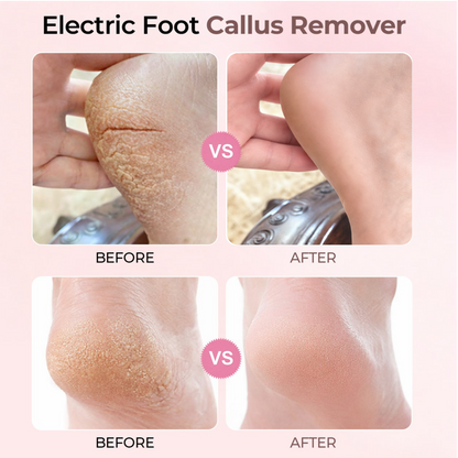 2026 New Upgraded Electric Foot File US