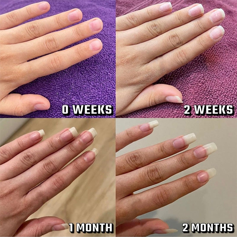 💮🌸Hot Sale🔥BUY 2 GET 1 FREE🔥Nail Growth Oil